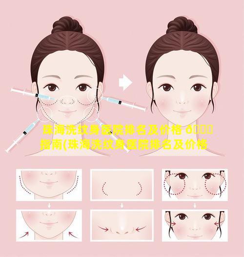 珠海洗纹身医院排名及价格 🐋 指南(珠海洗纹身医院排名及价格指南最新)